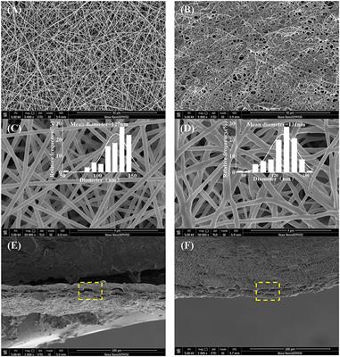 Facile Fabrication of Sandwich Structural Membrane With a Hydrogel Nanofibrous Mat as Inner Layer for Wound Dressing Application